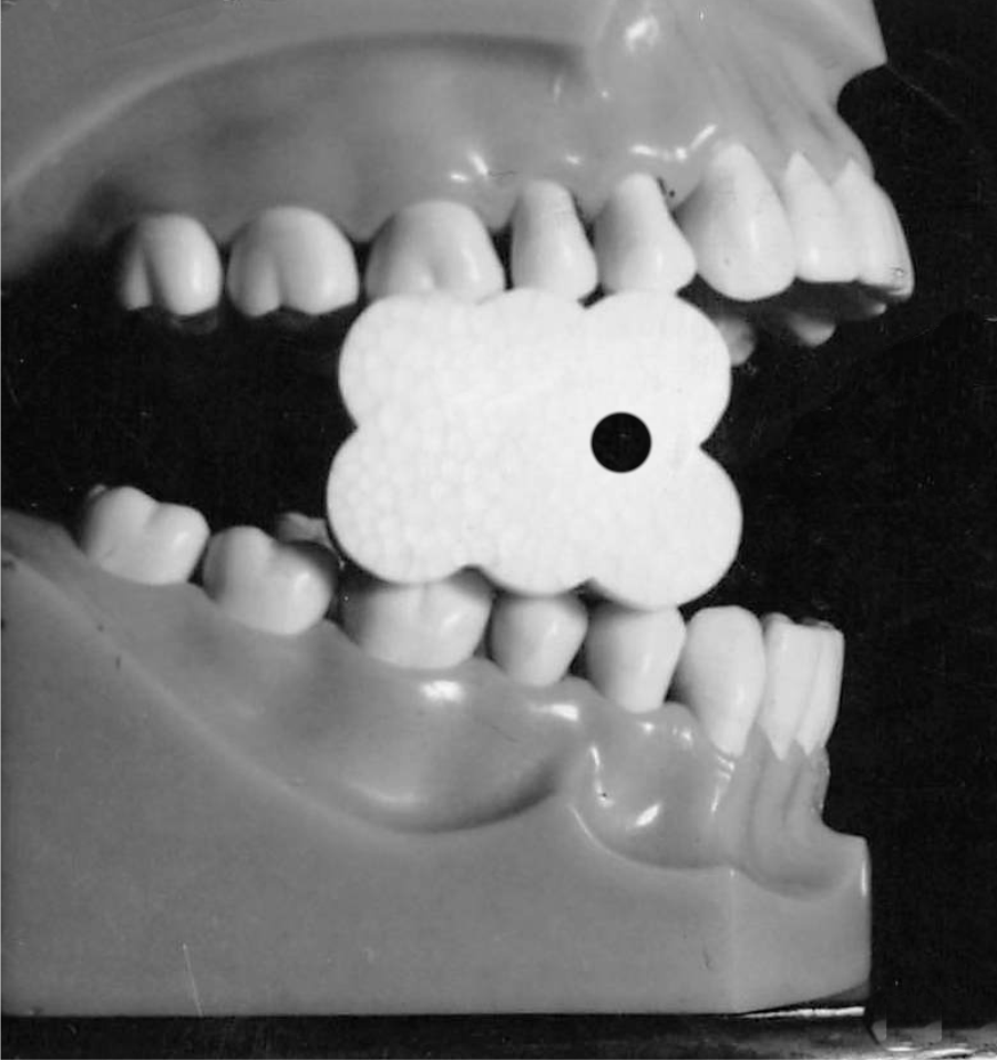 EZ Prop® ­ Disposable Mouth Prop - 100 count