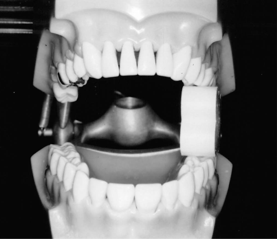 EZ Prop® ­ Disposable Mouth Prop - 100 count