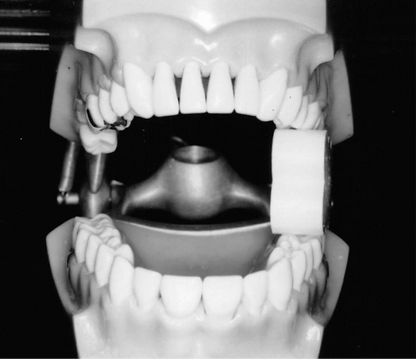 EZ Prop® ­ Disposable Mouth Prop - 100 count