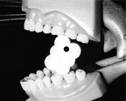 EZ Prop® ­ Disposable Mouth Prop - 100 count