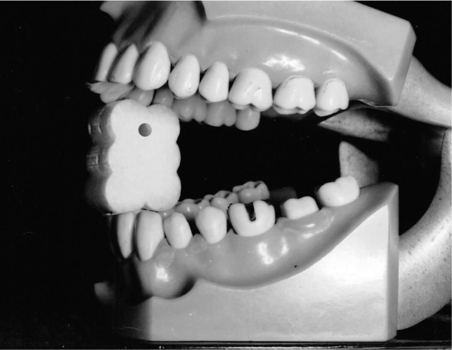EZ Prop® ­ Disposable Mouth Prop - 100 count