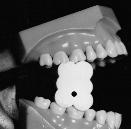 EZ Prop® ­ Disposable Mouth Prop - 100 count